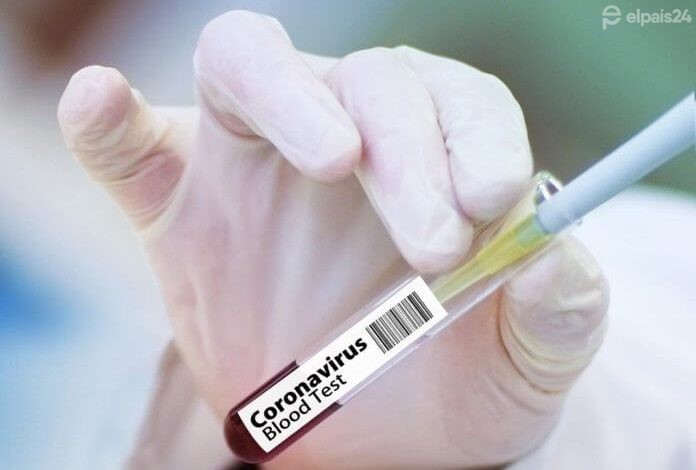 Pfizer versus Sputnik: duelo de vacunas